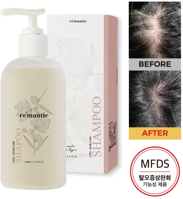 리맨틱 안티헤어로스 탈모완화 기능성 샴푸 / 약산성 두피 진정 남녀공용, 1개, 500ml - 쿠팡