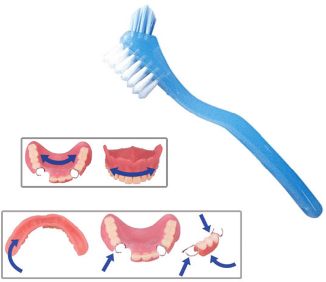 e75덴탈 틀니세트(틀니보관함+틀니칫솔+틀니세정제8정) 1세트, 1개