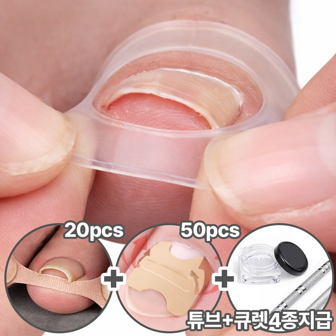 내성발톱 관리패키지 파고드는 내향성 발톱 밴드 테이프 실리콘 세트, 1개