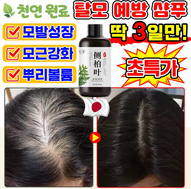 [천연식물추출] 탈모 예방 샴푸 비듬 약산성 지루성 두피 샴푸 두피 손상모 케어 관리 모근 강화 에센스 여성 남자 M자 탈모 완화 모발 성장 영양제, 1개, 300ml