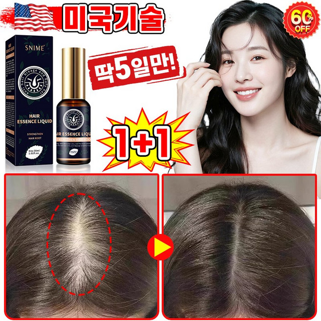 [빠른효과] 미국기술 1/1+1/2+2 두피 영양제 머리 발모제 모발 성장 촉진 에센스 탈모 방지 완화 두피케어 세럼 LUPEIYA 포장증정, 2개, 30ml