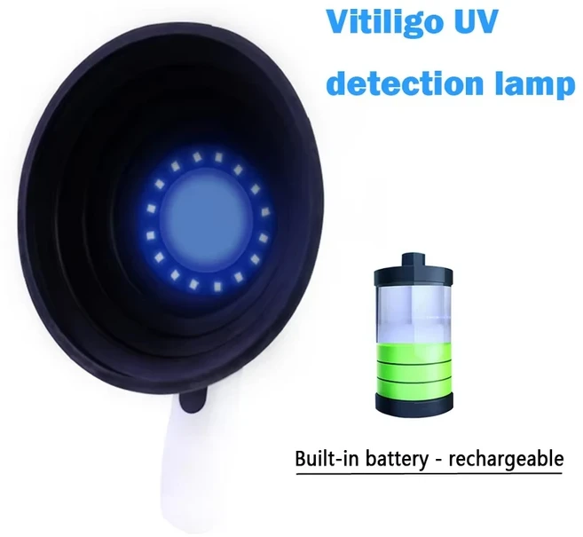Woods 램프가있는 피부 분석기 휴대용 백반증 감지기 분석 기계 가정용 장비 용 Led 충전식 조명, [01]rechargeable