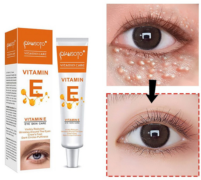 [국내배송] 눈밑 지방제거 크림 리프팅 900샷 아이크림 눈가문제 개선 크림 아이백 관리 크림 QIANSOTO, 1개, 20g