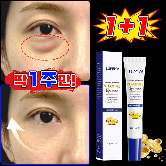 여성 아이크림1위 눈 밑 지방 제거 크림 주름개선 아이크림 눈가 리프팅 눈밑주름 제거 크림 영양크림 레티놀 아이크림 다크서클 눈밑 아이백 제거 콜라겐 아이크림 MOYALIE, 2개, 20g