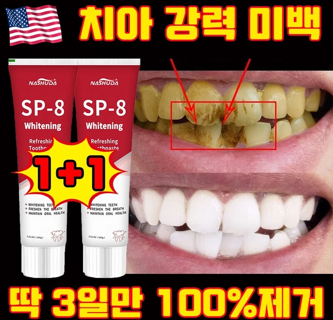 [3일만 효과보장] 1/1+1 미국 SP8 고불소 누렁니 미백치약 구취케어 치약 베이킹소다 효소 화이트닝 치약 입냄새 제거 선물 랜덤 증정, 2세트, 100g - 쿠팡
