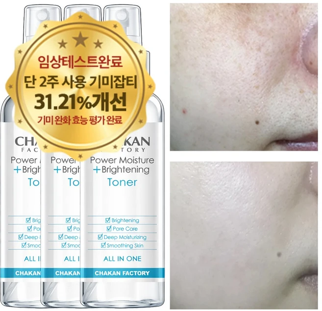 기미 잡티 주근깨 미백 색소침착 착색 검버섯 수분 보습 화이트닝 광채 기미잡티 미스트, 3개, 150ml - 쿠팡