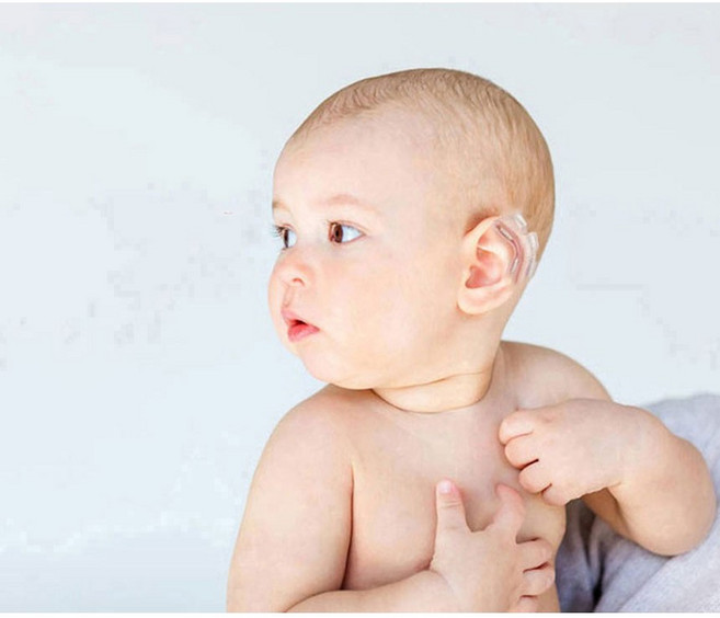 1등급 성형 부목 신고 의료기기 신생아 의료용실리콘 비행기알미늄 귀교정기 아기 접힌 귀교정 테이프, 1개