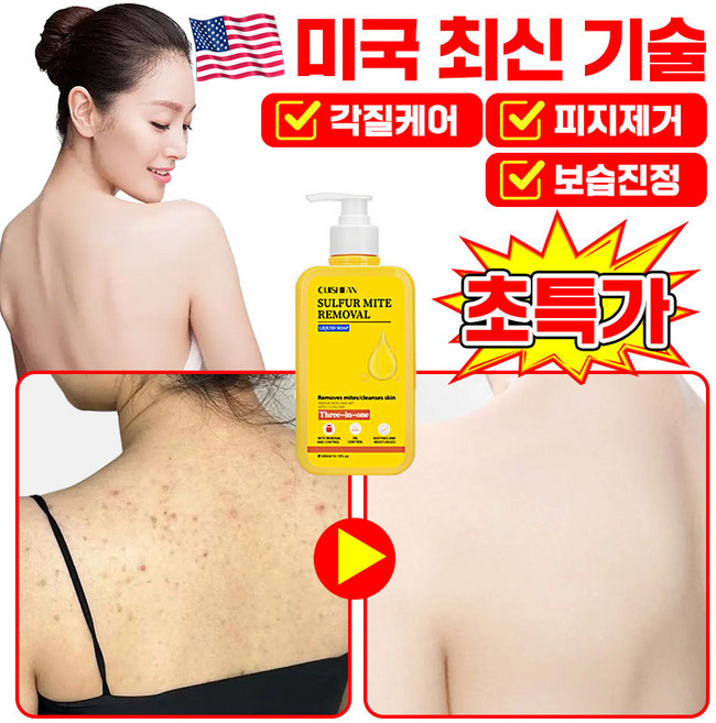 [효과보장]1/1+1 유황 바디워시100% 유황 바디워시 데일리 딥클렌징 샤워 물비누 향균 여드름 등드름 가려움증 개선 완화 피지감소 각질제거 고농축 목욕 입욕제, 1개, 300ml