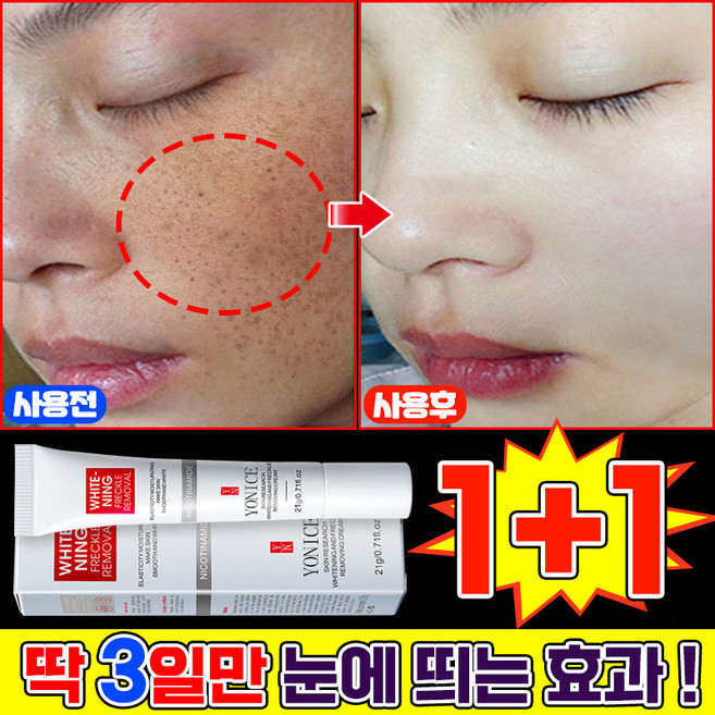 {국내배송 | 100% 효과있음} 1/1+1/2+2 기미크림 기미 잡티 주근깨 검버섯 제거 크림 색소침착 미백 크림 들깨기미크림 화이트닝 LUPEIYA, 2개, 20.01g
