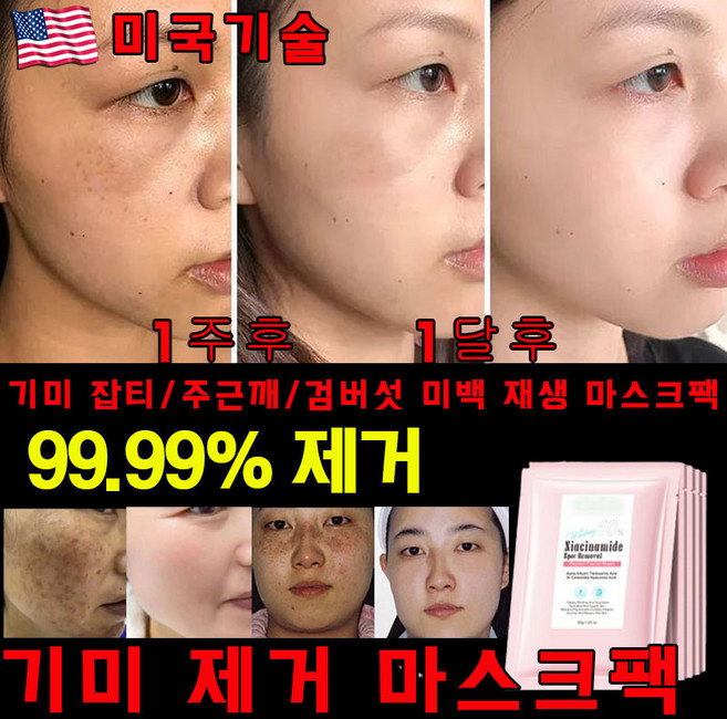 [효과짱] 멜라필 기미 미백 패치 색소침착 검버섯 흑자제거 미백 마스크팩 멜라논 멜라닌 크림 광책 화이트닝 얼굴 기미팩, 1개, 5개입