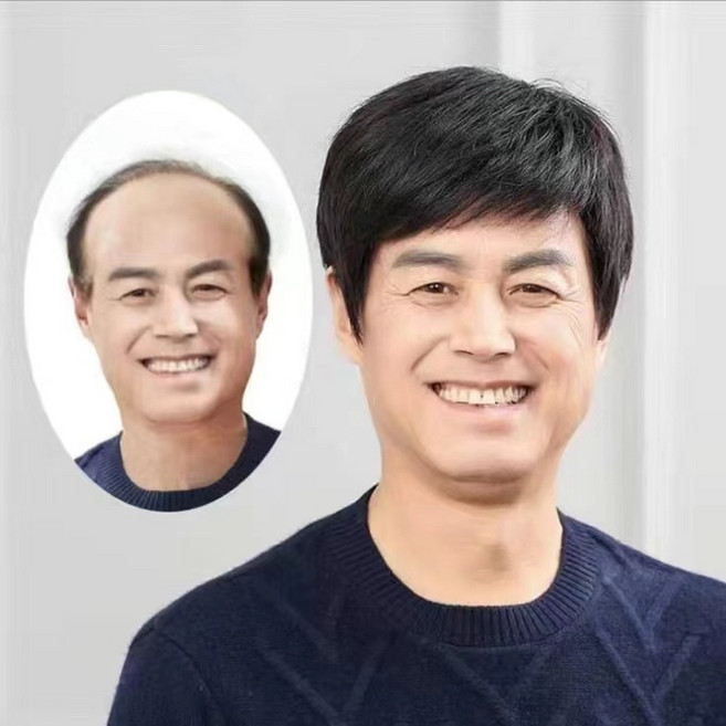 상덕 정수리가발 남자가발 중년 가발 숏컷 자연스러운 고급, 1개, 블랙