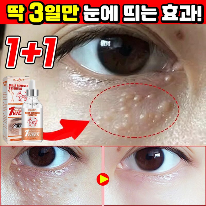 [효과보장] 1/1+1/2+2 눈밑 지방제거 에센스 비립종 제거 앰플 피부요철 각질제거 눈가주름 개선 다크서클 눈밑꺼짐 아이백 아이크림 LUPEIYA, 2개, 30ml