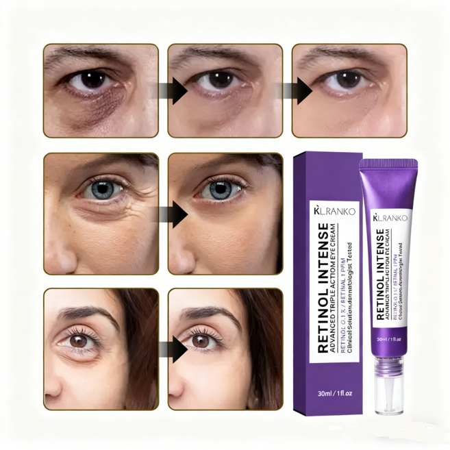 아이백 리프트 1100샷 리들 패치 리프팅 900 아이크림 눈 밑 지방 제거 크림 눈밑지방 아이백, 1개, 30g