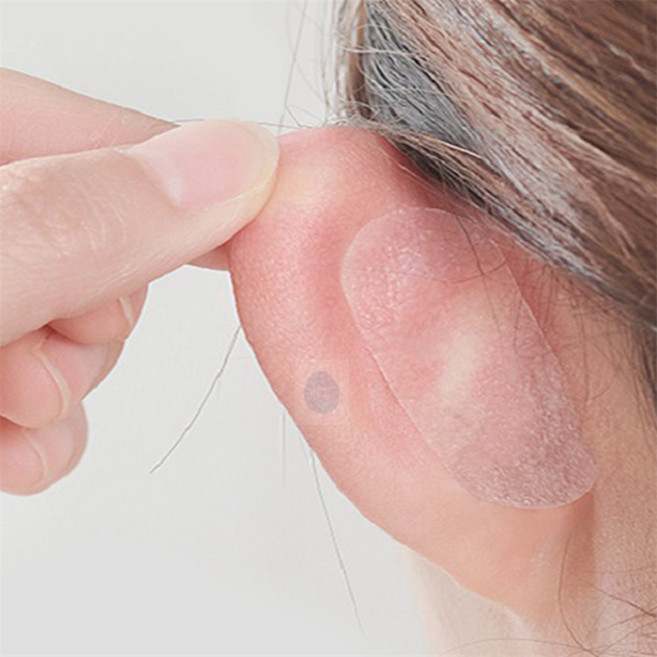 파랑파랑몰 누운귀 성형스티커 미용용, 홈있음, 1개