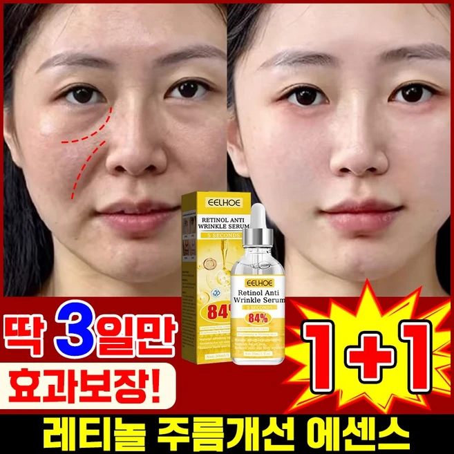 [피부과추천] 미국 1/1+1/2+2 레티놀 앰플 주름 개선 에센스 모공수축 레티날 세럼 모공앰플 피부 리페어 포장증정, 2개, 30ml - 쿠팡