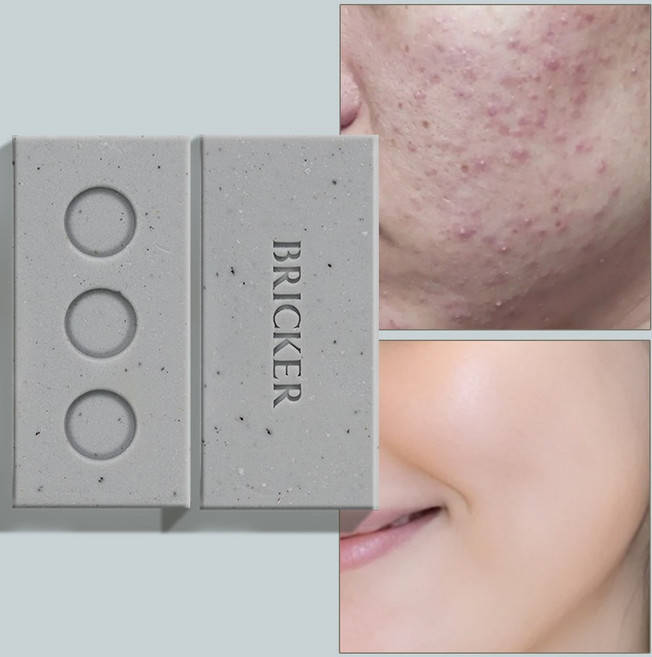 브릭커 머디 어성초 CP 천연비누 (머드팩 고체팩), 2개입, 140g