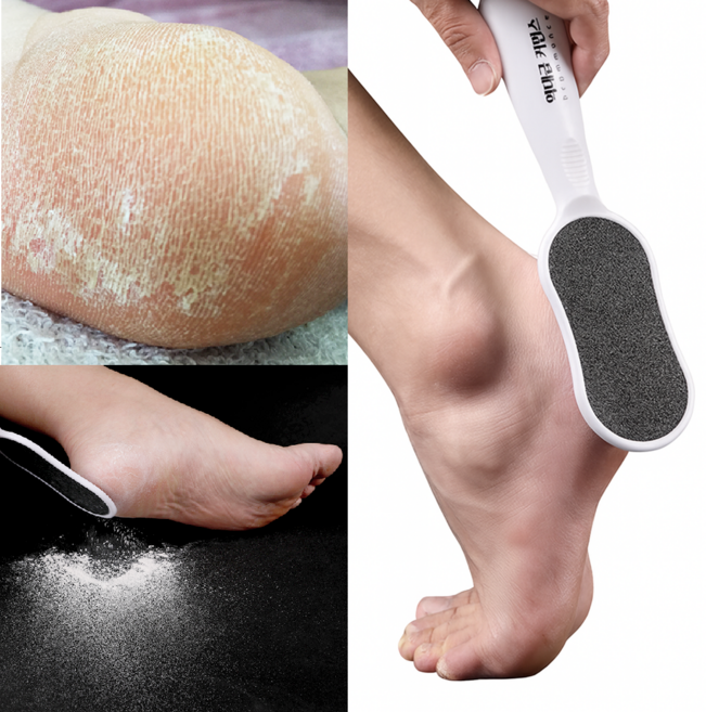 역대급커먼스 풋파일 각질제거기, 1개, 1개입