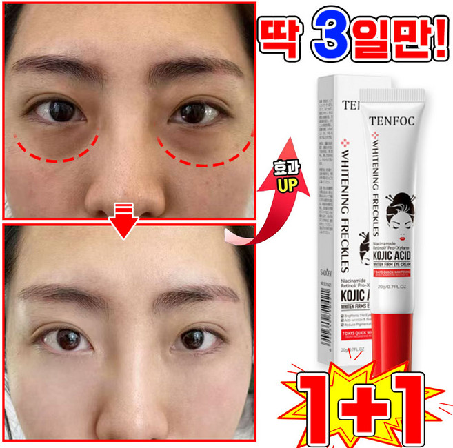 [국내배송] 1/1+1/2+2 다크서클 눈밑꺼짐 개선 아이백 아이크림 아이팔트 아이백 크림 눈밑 지방제거 눈 밑 지방 볼륨 개선 눈가 주름개선 리프팅 아이케어, 2개, 20.01g