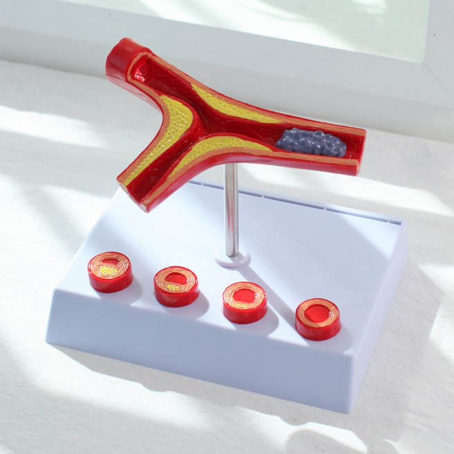 정수생활건강 인체모형 동맥 혈관 인체 해부학 교육 실습용, 혈관모형 A, 1개