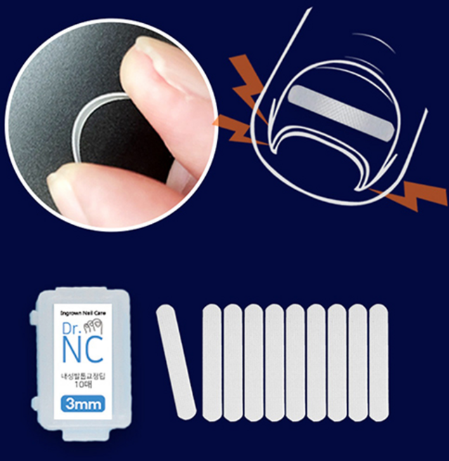 닥터엔씨 교정팁 파고드는 내성발톱 자가치료 테이프 3종 (3mm 4mm 5mm), 3mm, 1개