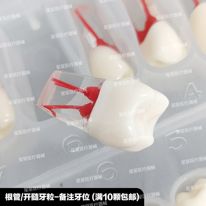 치과재료 가짜이빨 임시치아 28개 치과용 고정 치아 연습용 의치 나사 탈착식 개별 나사형 레진 타이포돈 모델, 근관/개수연습치립 고경도,침착하지 않음, 1개