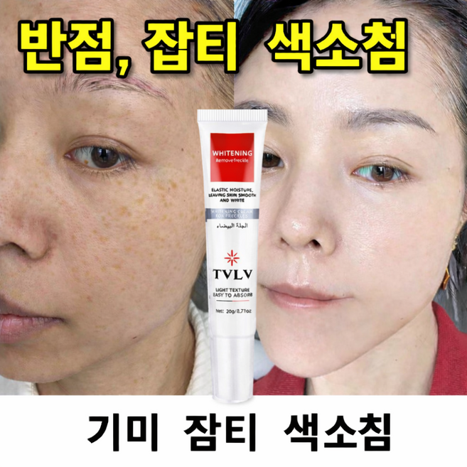 기미 잡티 제거 크림1위 트라넥삼산 기미크림 트라넥삼산 100% 정품 크림 기미 잡티 미백 라논 크림 함익병, 1개, 20g