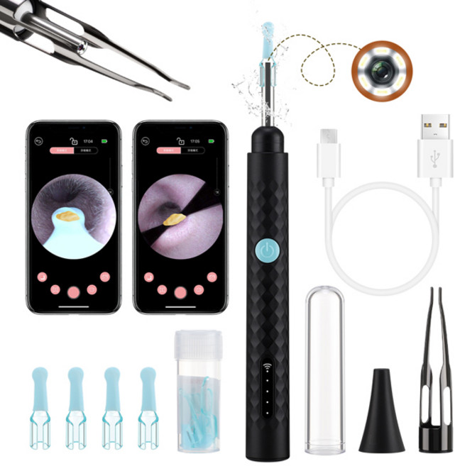 2-in-1 비주얼 귀지 제거기 카메라 HD 내시경 귀지 제거 도구 세트 제거용 핀셋 귀이개, 02 검정색