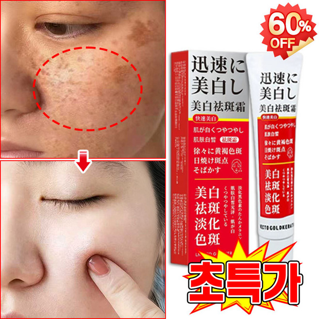 [피부과 추천] 멜라논 멜라닌 크림 기미크림 기미 잡티 검버섯 주근깨 제거 크림 착색 미백 크림 들깨기미크림 색소침착 화이트닝크림 LUPEIYA, 1개, 38g