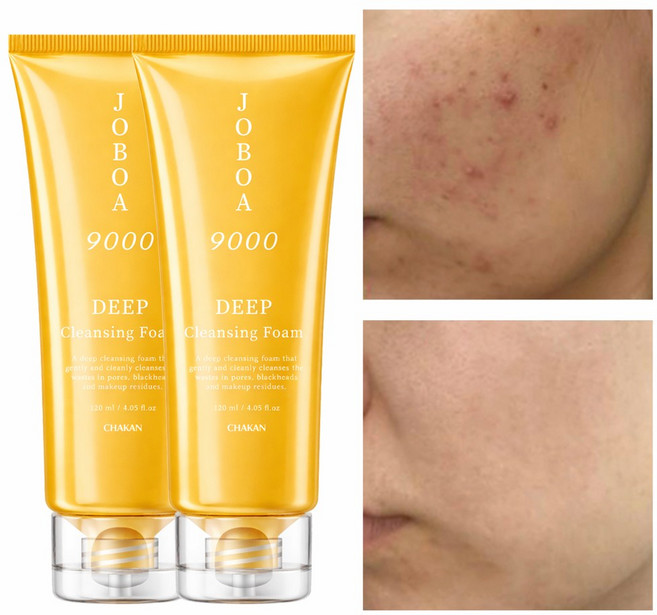 여드름 모공 각질 노폐물 제거 호호바 9000 딥 클렌징폼, 120ml, 2개
