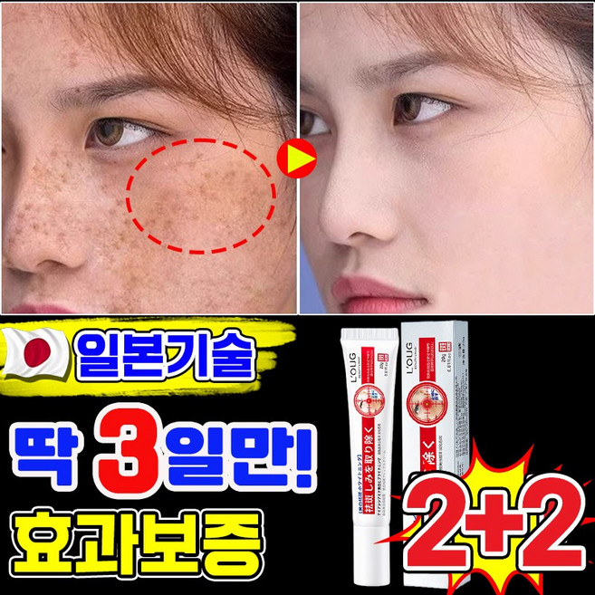 일본기술 기미크림 기미 잡티 검버섯 흑자 제거크림 멜라논 멜라닌 크림 착색 미백 크림 색소침착 LUPEIYA 포장증정, 4개, 20g