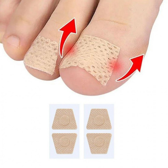 내성 발톱 밴드 2P 손톱 케어 보호 테이프 보호대 발톱팁 교정 도구 교정기 관리_rl