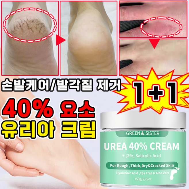 유리아 크림 우레아 풋크림 100% 함익병 유레아 크림 발 뒷꿈치 보습크림 발각질 제거 피부연화제 고보습 풋크림, 150g, 2개, 1개입