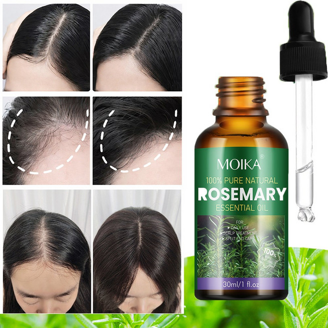 [탈모 케어] 미국기술 로즈마리 탈모앰플 머리 나는 탈모치료제 모발 성장 모낭 활력강화 발모제 두피 영양제 여성 탈모 앰플 두피앰플 두피에센스 스칼프 부스팅 앰플, 1개, 30ml
