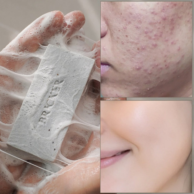 브릭커 머디 어성초 CP 천연비누 (머드팩 고체팩), 1개입, 140g