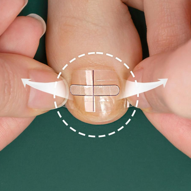 10매+10매 퍼펙토 내성발톱 교정기 스트립 교정팁 의료기기 자가치료 세트, 20개