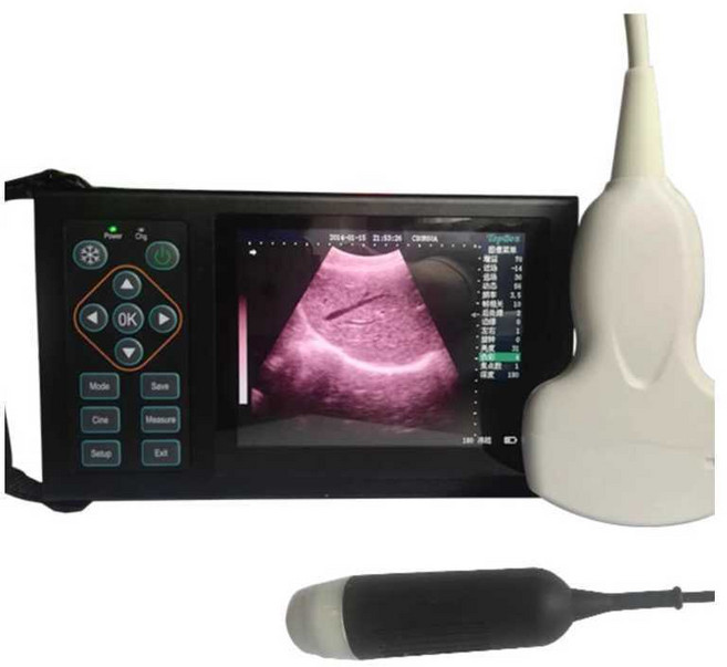 지방 초음파 측정기 진단기 등 소 두께 말 양 수의, 3세대 고화질 초음파기기, 1개