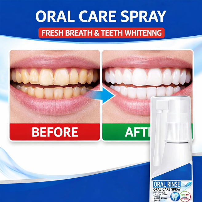 구강유산균 스프레이 뿌리는 구강유산균 휴대용 구강스프레이 입냄새제거 스프레이 입냄새 제거 셀프 치석 제거 뿌리는 구강청결제 구강 유산균, 1개, 30g