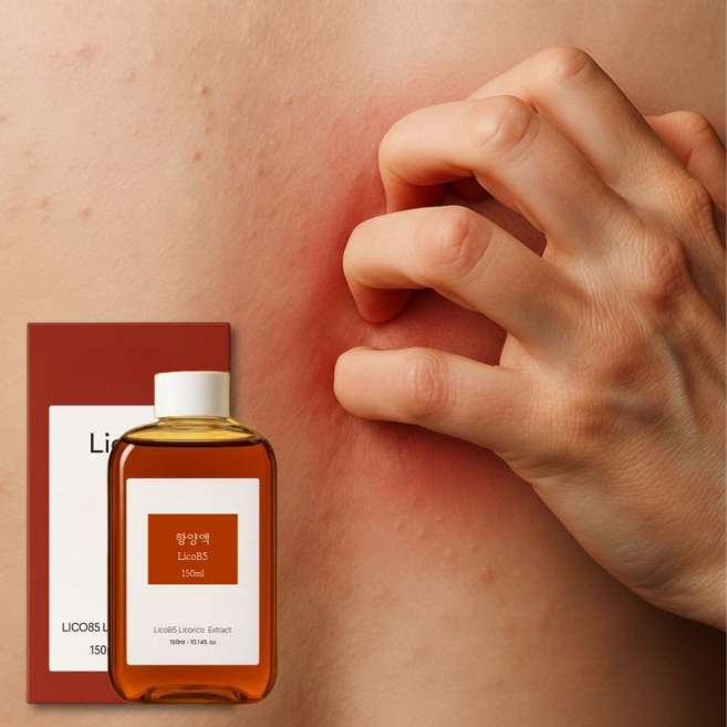 항양액 피부 가려움 진정액 진양 스프레이 (포그샷 분사 스프레이 공병 개당 증정), 1개, 150ml