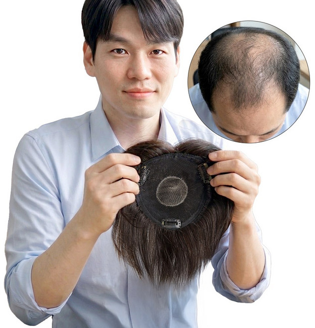인모 100% 남자 정수리 가발 펌스타일 M자 탈모 커버, 1개, GT진한갈색_중