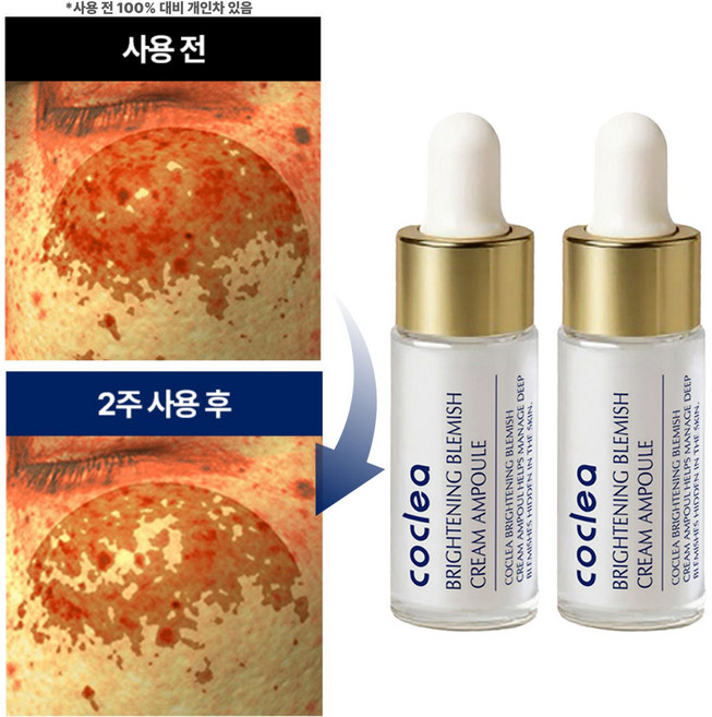 코클레아 브라이트닝 레티놀 콜라겐 기미 잡티 앰플 10ml 2개
