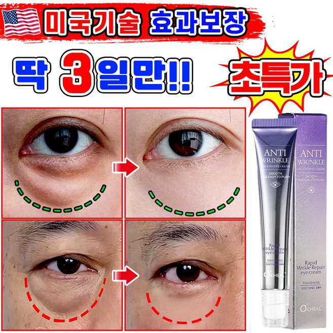 [효과보장] 1/1+1/2+2 아이백 리프팅 900샷 아이크림 눈 밑 지방 볼륨 개선 눈밑지방 제거 아이백 크림 다크서클 눈밑꺼짐 제거 아이케어 LUPEIYA 포장증정, 1개, 20g