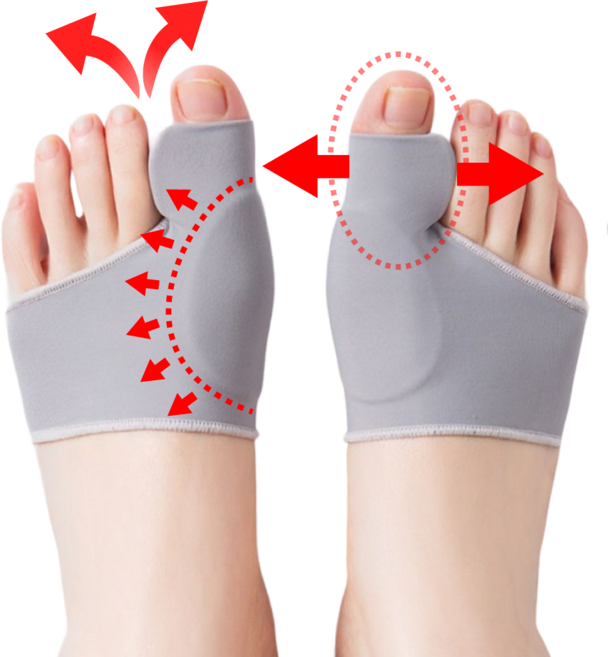 원브론 외출용 엄지발가락 보호대 분리 밴드, 1세트