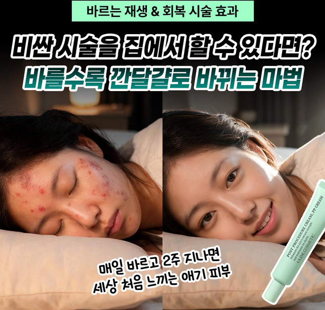 [유라인코스메틱] 포스트 프로시져 멍크림, 30ml, 1개