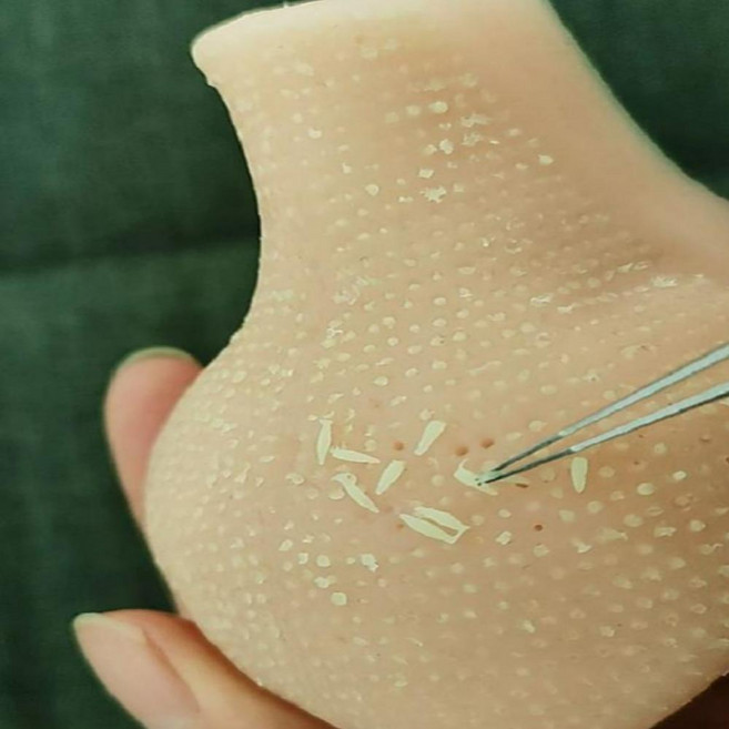 블랙헤드 딸기코장난감 피지뽑기 여드름짜기 스트레스해소, 딸기코 한개