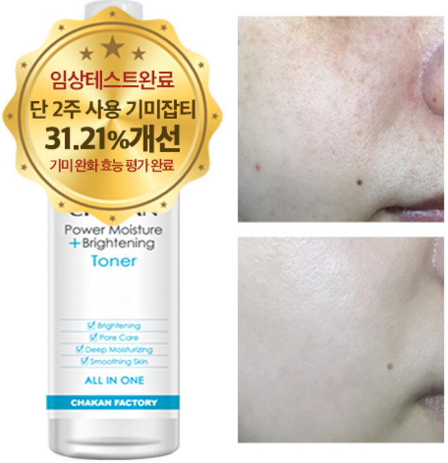 기미 잡티 주근깨 미백 색소침착 착색 검버섯 수분 보습 화이트닝 광채 기미잡티 미스트, 1개, 150ml