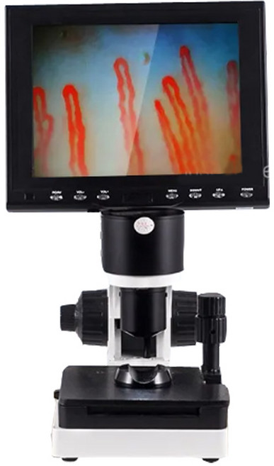 아로 혈류현미경 조갑주름모세혈관 관찰 혈관 혈액순환, 3.600배 롱 혈류현미경, 9인치