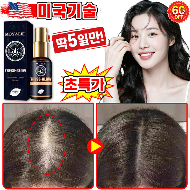 [빠른효과] 미국기술 1/1+1/2+2 두피 영양제 발모제 머리 모발 성장 촉진 에센스 탈모 방지 완화 두피케어 세럼 LUPEIYA 포장증정, 1개, 30ml