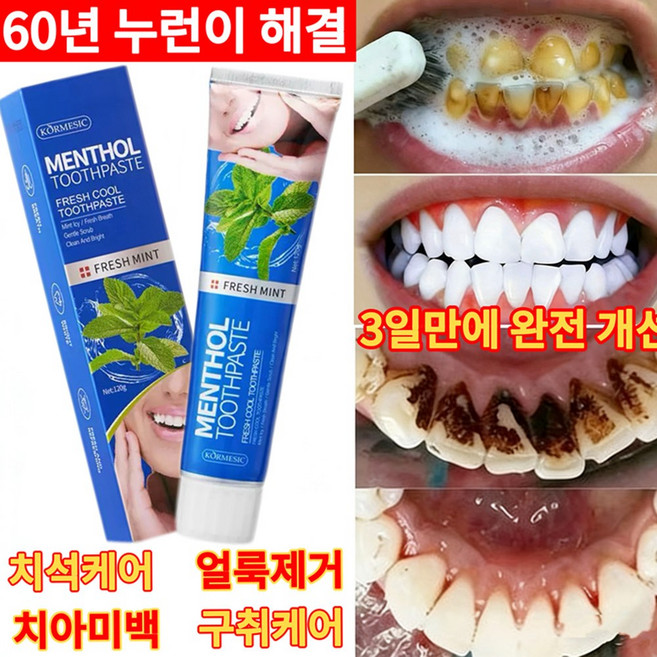 {독일개발|당일배송}첫 번째 화이트닝 치약으로 안전하고 자극없이 스케일링 담뱃때 제거 충치예방 황치미백 치아에 대한 다양한 고민을 해결해줍니다., 1개, 120ml