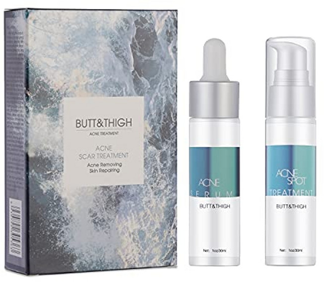 엉덩이 여드름 제거 치료호치토 낭포성 여드름 치료 엉덩이 여드름을 제거하고 반점을 감소 신체 여드름 흉터 치료 뾰루지 방지30 ml1 oz1 oz, 1 온스, 1개