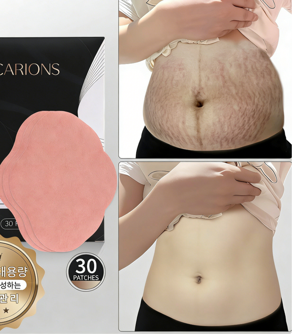 [다이어트 /셀룰라이트패치 ]10일의 기적 뱃살 집중 슬리밍패치 복부 집중 케어 셀룰라이트 제거 노폐물 배출 붓기 완화까지, 3개, 30개입